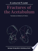 Fractures of the Acetabulum