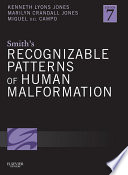 Smith’s Recognizable Patterns of Human Malformation E-Book