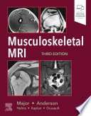 Musculoskeletal MRI E-Book