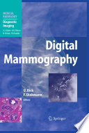 Digital Mammography
