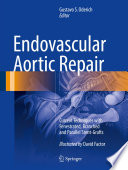 Endovascular Aortic Repair, Current Techniques with Fenestrated, Branched and Parallel Stent-Grafts